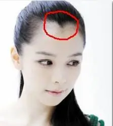 美人尖是什么意思