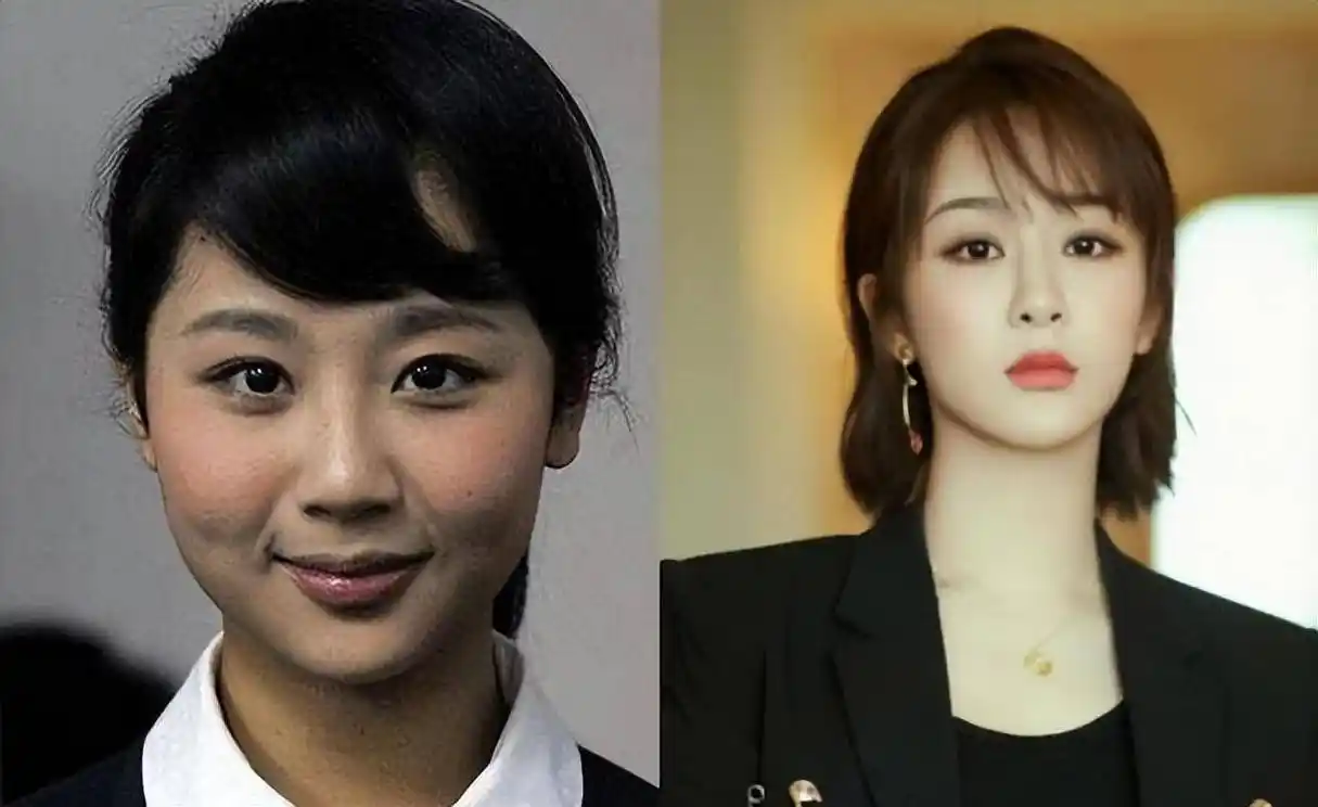 盘点娱乐圈5位整容最成功的女明星,前后判若两人,却毫无痕迹_脸部