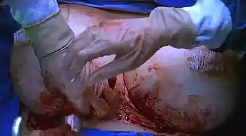 最血腥的其实是他们:美剧十大名医!