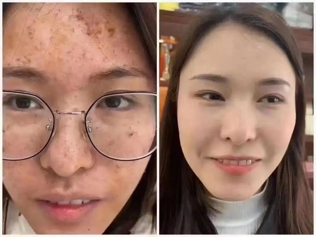 希洛缇.#同城精选 #济源市 全城搜集《斑女郎》 斑花·斑主 - 抖音