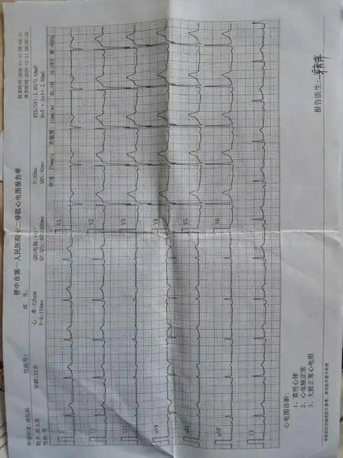 2016年11月11日在晋中市第一人民医院做的心电图检查报告单