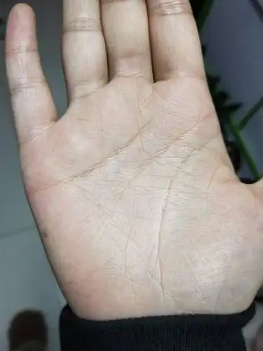 女 双手都是川字纹