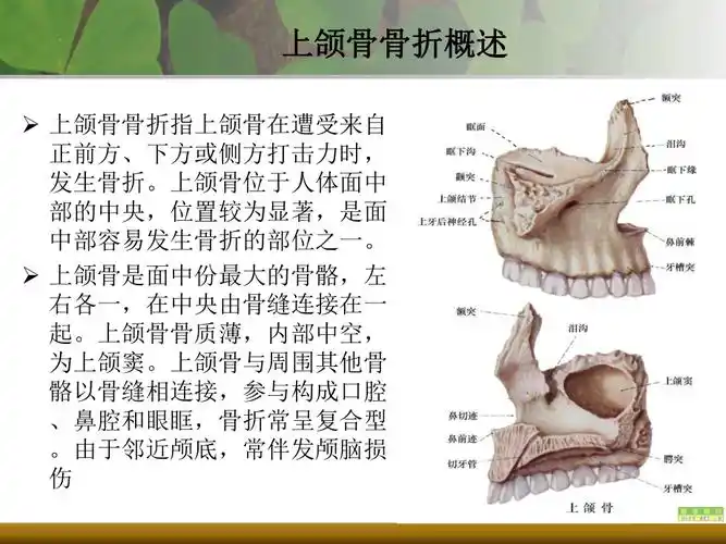上下颌骨骨折共21页