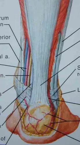 20080818医生看刘翔脚跟伤