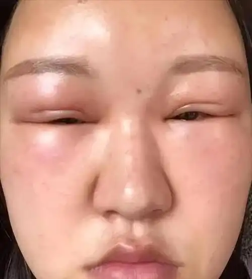 整容脸上镜有多拉垮终于知道张艺谋坚决不用整容脸的原因了