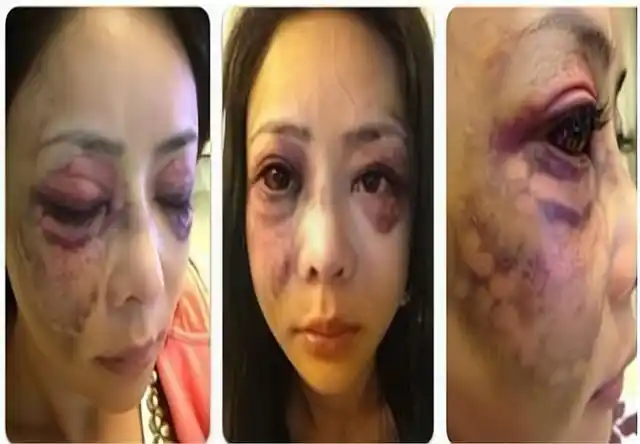 女明星被"家暴",韩国女明星被捅数刀,曾出演《回家的诱惑》