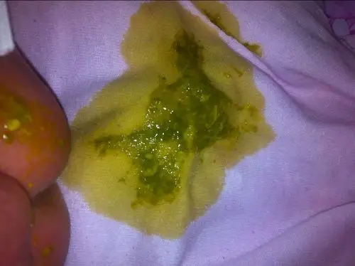 需要进一步化验大便常规确诊,如果肠炎可以服用头孢克污混悬剂或者