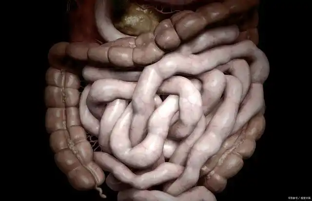 出现4大征兆,警惕肠梗阻,医生告诉你4个注意事项,别再忽视了!