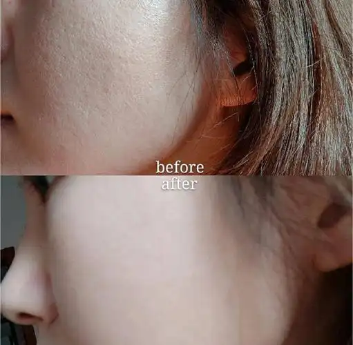 大毛孔 粗糙瑕疵皮,一抹搞定