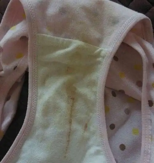 3岁女儿内裤有带血分泌物,医生检查后宝妈惭愧不已