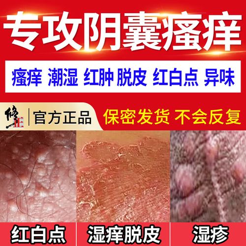 修正阴囊潮湿瘙痒阴囊炎睾丸瘙痒脱皮肛门大腿内侧蛋蛋男性抑菌止痒膏
