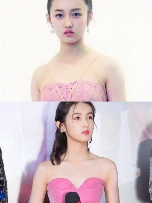 张子枫的直角肩秘籍你值得拥有·95张子枫得斜方肌发达_圈子-新氧