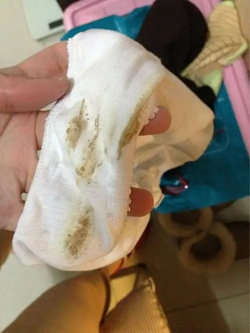 妈蛋这到底是白带还是姨妈还是什么啊好烦躁(图略重口慎入)