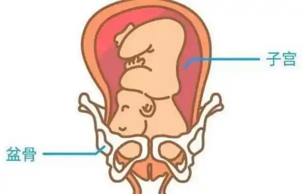 小孩入盆了还是啥意思(小孩入盆是什么意思)