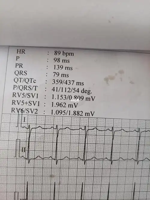 有看的懂的姐妹吗诊断结果是 窦性心律 和心电轴右偏这种状况 严重吗