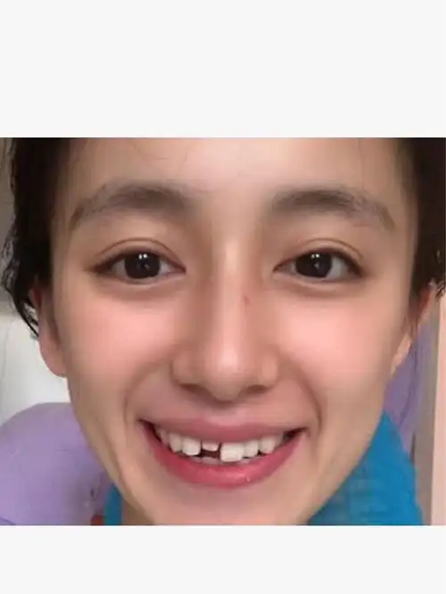 黑尾酱到底整容了么?当她的童年照曝光后,网友原形毕露了吧!