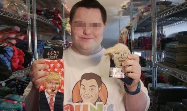 患有唐氏综合征的宝宝面部特征很明显婴儿阶段就能看出来