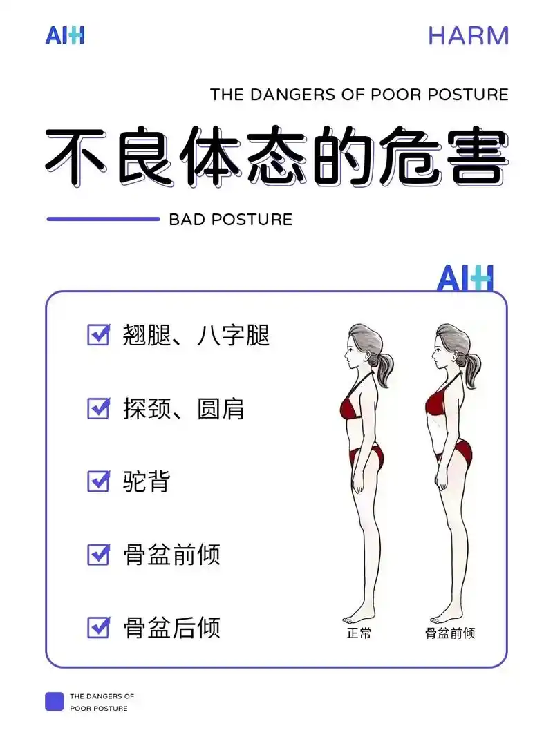 这些常见的不良体态你有吗7171.