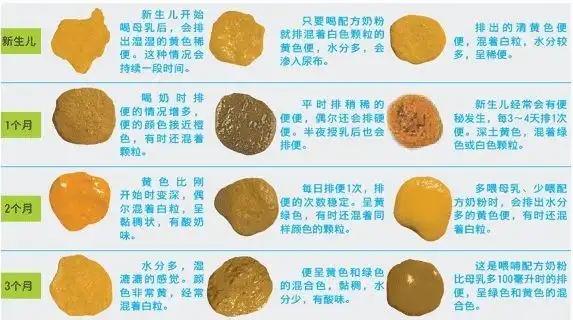 宝宝大便颜色,次数参照表!警惕异常大便,影响宝宝健康发育