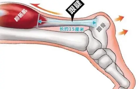 刘微笑早会主题11/365★临床心得08:《跟腱(足后跟)疼痛》刘氏经筋