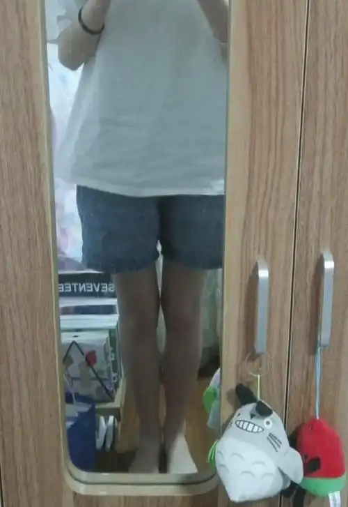 家人们这腿正常吗膝盖往中间走01