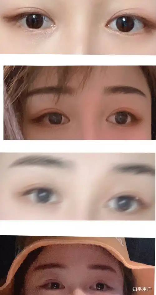 抑郁的人眼神都很空洞吗