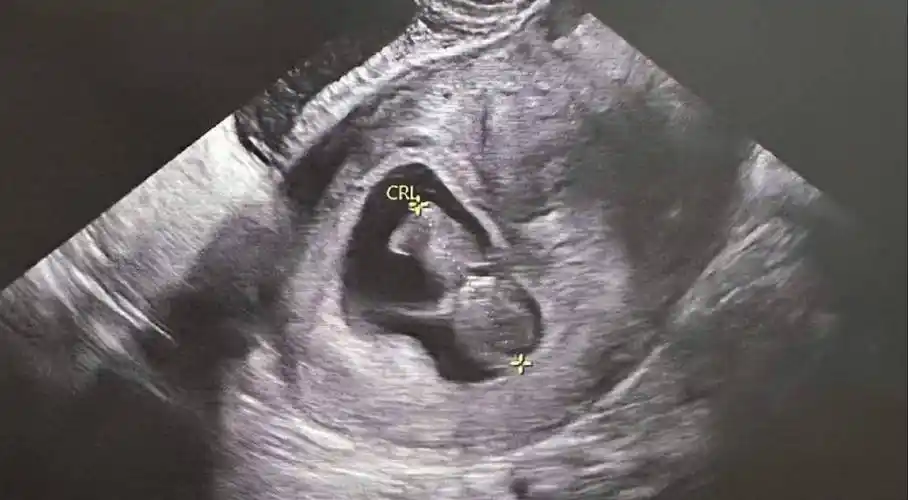 但按照外界的猜测,杨潮凯的妻子江玉仪目前怀孕已经超过三个月,预产期