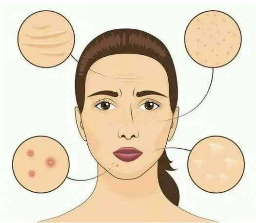 肤色暗沉,皮肤松弛,不注意抗初老分分钟老十岁