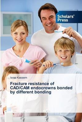 预订fracture resistance of cad/cam endocrowns bonded