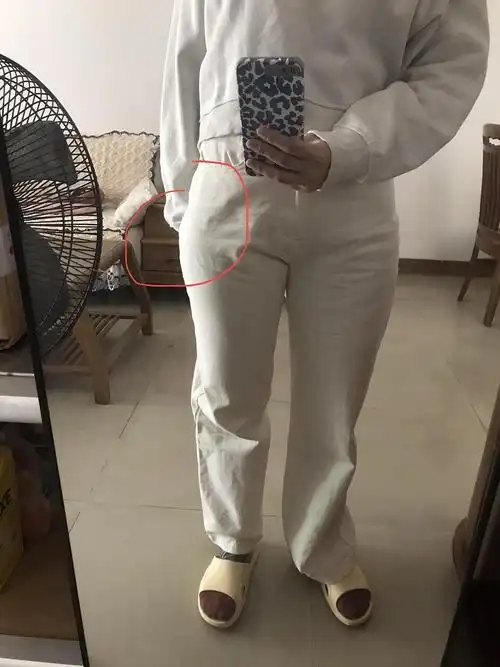 我感觉我的大腿骨头走向是这样的,加上我大腿前侧突出,导致这个骨头