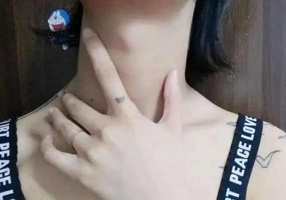 假如喉结明显是不是不正常