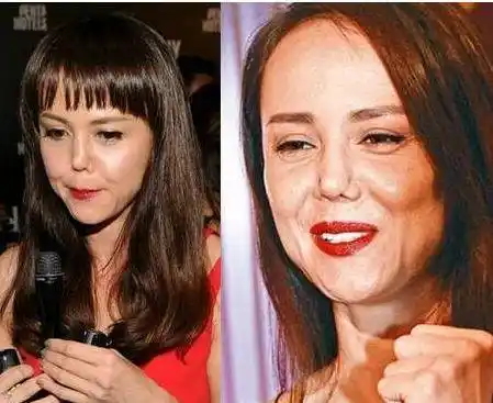 娱乐圈中这些整容失败的女明星,真是让人不忍直视!