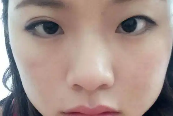 双生痣是什么意思好不好