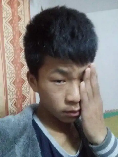 男生15岁脸上长痘痘怎么让他消失