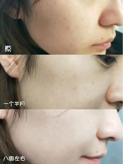 美白祛斑的护肤品哪个品牌好第二款:科颜氏淡斑精华这款又叫安白瓶