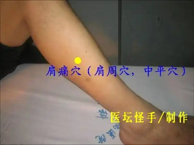 【】[转] 肩周炎特效穴位集锦