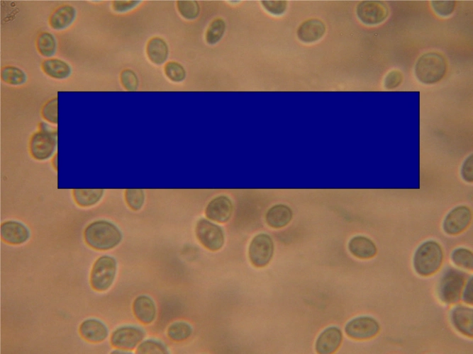 酵母细胞的固定化(公开课)研究.pptx