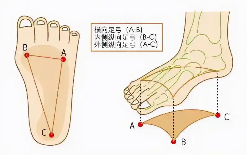 脚底板爱生茧子,走路疼痛是怎么回事?或是这些部位出现了问题