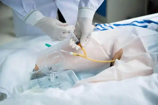 男护士亲述第一次给女患者导尿表示自己好羞涩