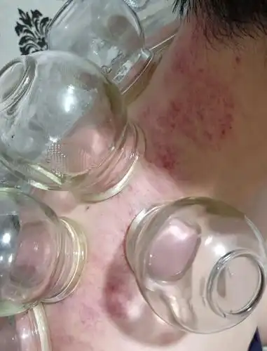 习砭实践(副本)(副本) - 美篇