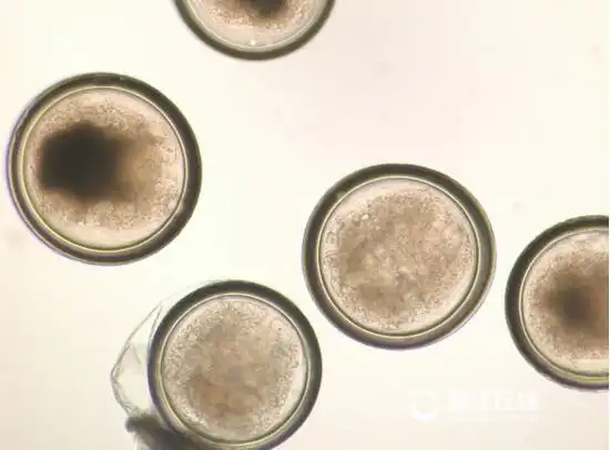 海淘鱿鱼干检出寄生虫 这些产品你还敢跨境买吗?