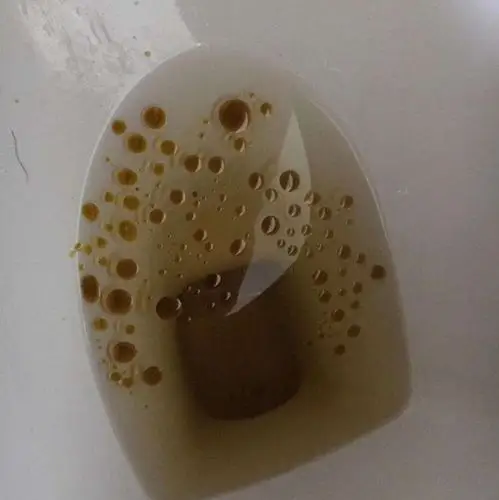 亲身经营那些吃过的减肥药,大盘点!