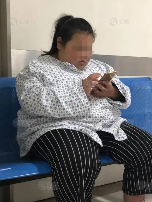暑期警惕孩子发胖,看12岁超胖小女孩如何减重40斤