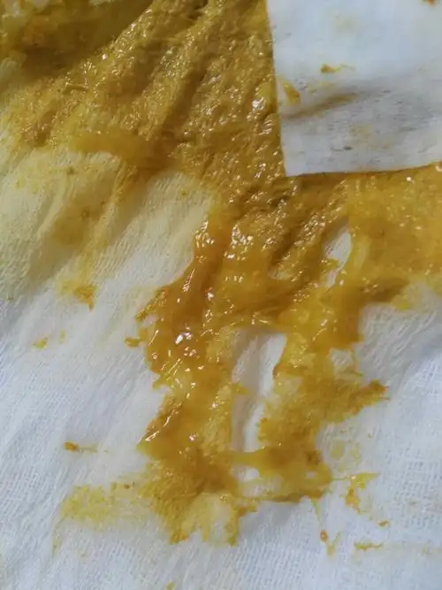 大便粘稠很臭怎么治疗 - 三伊五百科