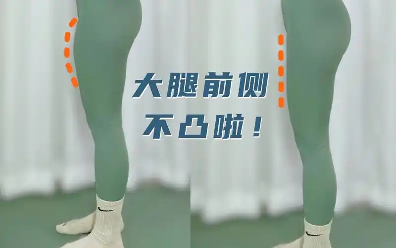 大腿前凸有救啦6015根源性瘦大腿前侧97超简单73