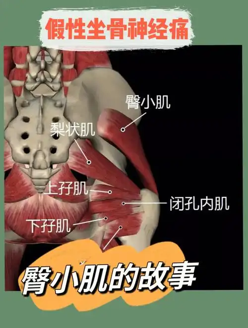 它与臀中肌一起是我们平时生活中走路站立保持良好的姿势的重要肌肉