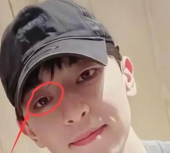 疑似割双眼皮大变样,引起网友热议|邓伦|复出|整形手术_新浪新闻