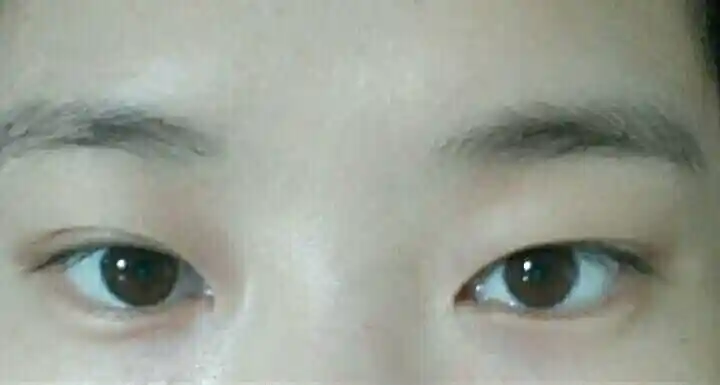 眼皮长得一单一双是一种怎样的体验?