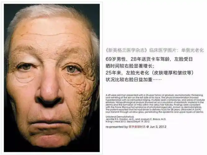 皮肤衰老的4大原因,找对方向才能轻松抗老!