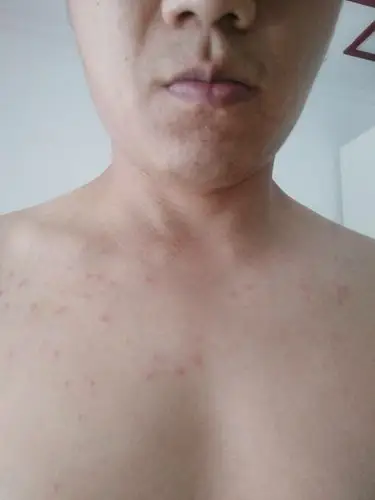 身上起了小红点请帮我看看_百度知道